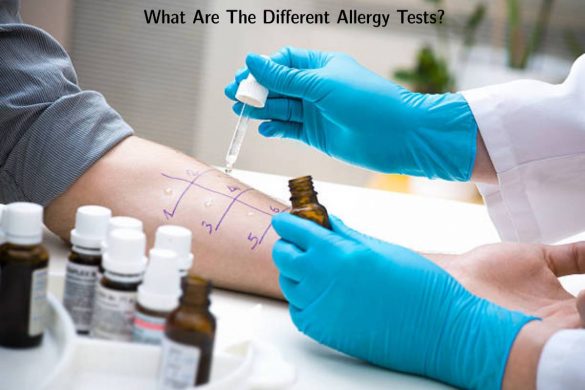 What Are The Different Allergy Tests