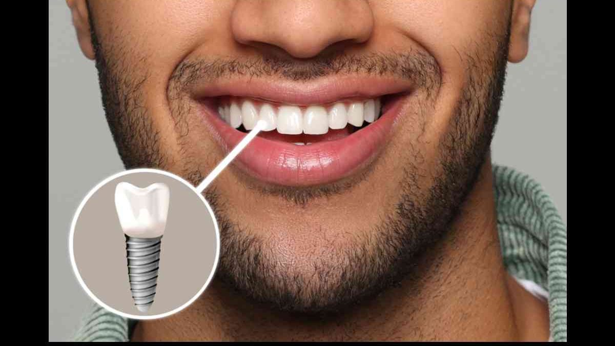 What Are Perfect Teeth Supposed To Look Like