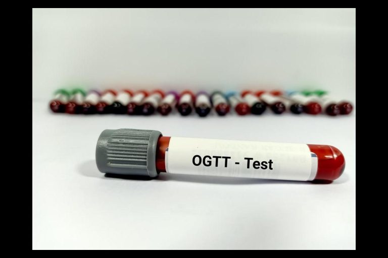 OGTT Test: How To Detect Gestational Diabetes?